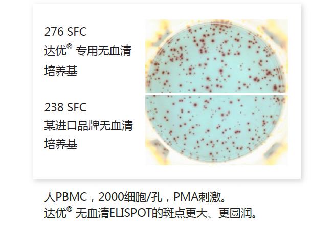 人淋巴細胞無血清培養基-斑點2.jpg